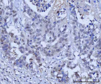 Anti-RAD51C Antibody