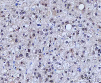 Anti-RAD51C Antibody