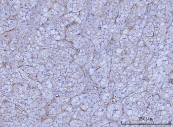 Anti-WRS/WARS1 Antibody