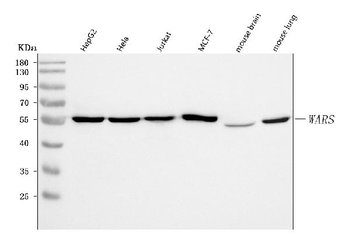 Anti-WRS/WARS1 Antibody