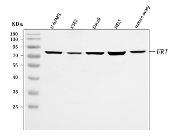 C19orf2/URI1 Antibody