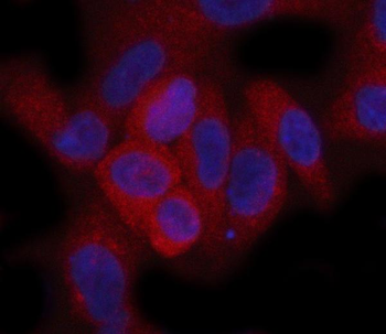 Anti-Hamartin/TSC1 Antibody