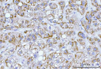 Anti-Hamartin/TSC1 Antibody