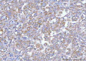 Anti-Hamartin/TSC1 Antibody