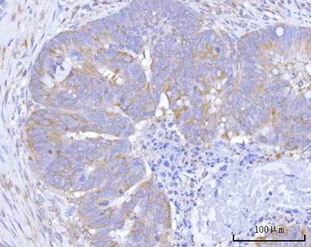 Anti-Hamartin/TSC1 Antibody