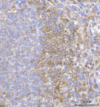 Anti-Hamartin/TSC1 Antibody