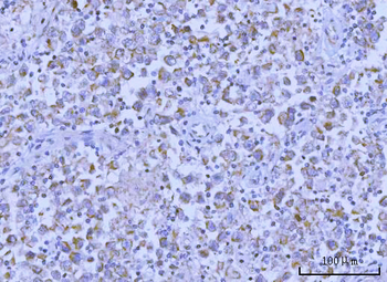 Anti-Hamartin/TSC1 Antibody