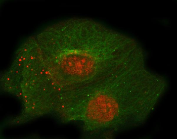 Anti-Thrombomodulin/THBD Antibody