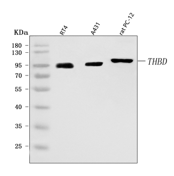 Anti-Thrombomodulin/THBD Antibody
