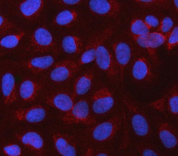 Anti-CBLIF Antibody