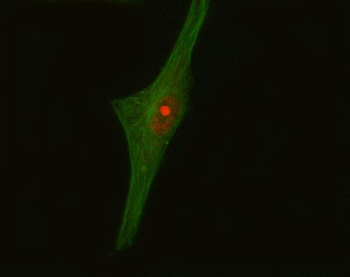 Anti-CRKL Antibody