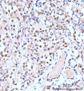 Nesprin3/SYNE3 Antibody