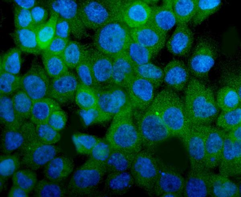 Anti-ITGA8 Antibody