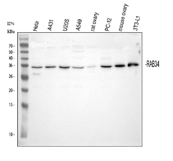 Anti-RAB34 Antibody
