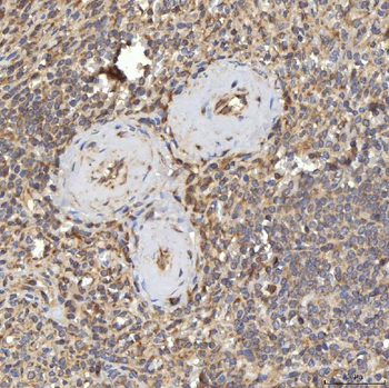 Anti-RBMS1 Antibody