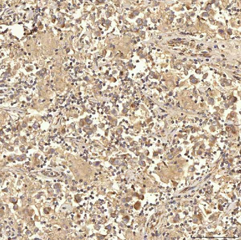 Anti-RBMS1 Antibody