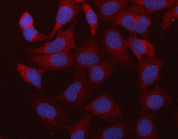 Anti-RBMS1 Antibody