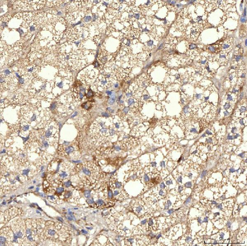 Anti-RBMS1 Antibody