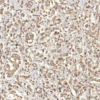 Anti-RBMS1 Antibody