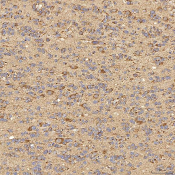 Anti-RBMS1 Antibody