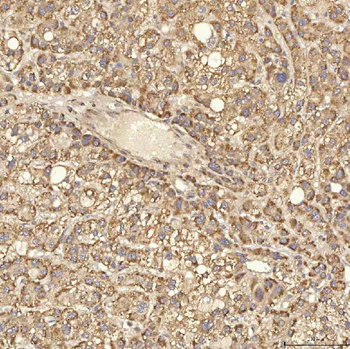 Anti-RBMS1 Antibody
