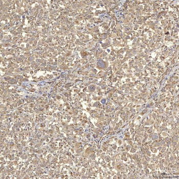 Anti-RBMS1 Antibody