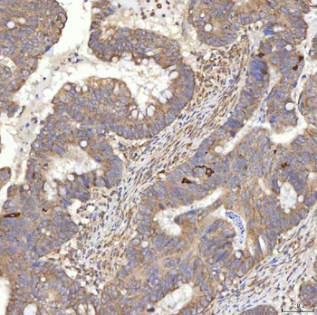 Anti-RBMS1 Antibody