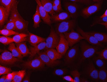 Anti-NQO1 Antibody