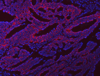 Anti-NLRX1 Antibody