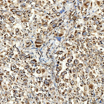 Anti-NLRX1 Antibody