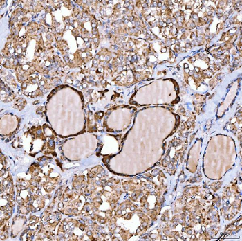 Anti-NLRX1 Antibody