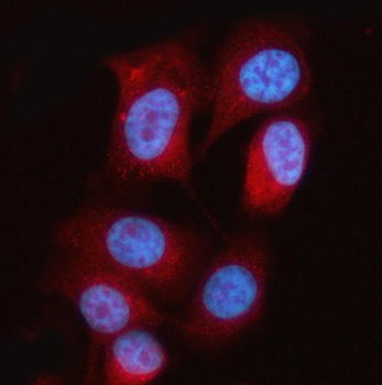 MTAP Rabbit Polyclonal Antibody