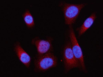 Anti-Lipin 1/LPIN1 Antibody