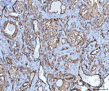 Anti-PTRF/CAVIN1 Antibody