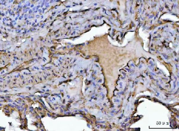Anti-PTRF/CAVIN1 Antibody