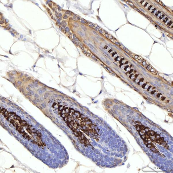 Anti-Cytokeratin 1/Krt1 Antibody