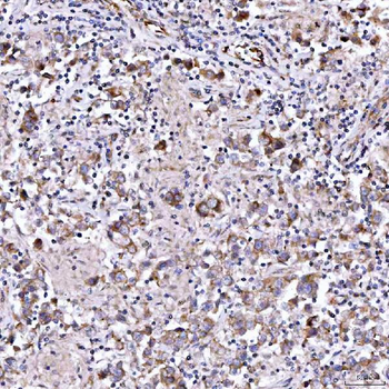 Anti-RAB3GAP1 Antibody