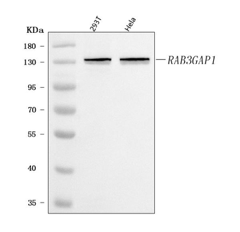 Anti-RAB3GAP1 Antibody