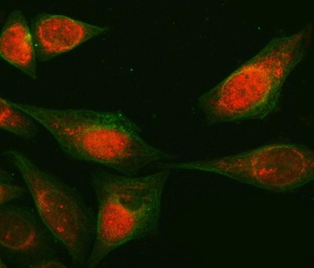Anti-RAB3GAP1 Antibody
