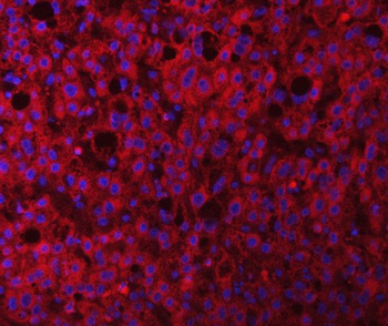 Anti-RAB3GAP1 Antibody
