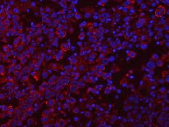 Anti-RAB3GAP1 Antibody