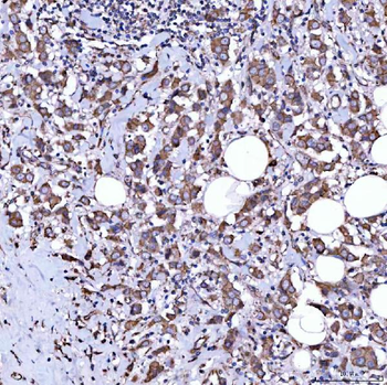 Anti-RAB3GAP1 Antibody