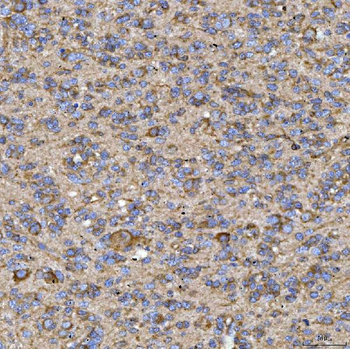 Anti-RAB3GAP1 Antibody