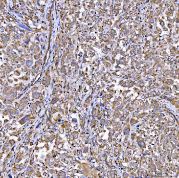 Anti-RAB3GAP1 Antibody