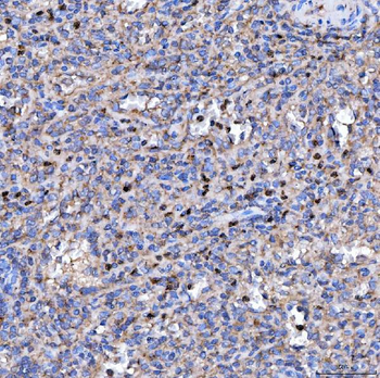 Anti-RAB3GAP1 Antibody