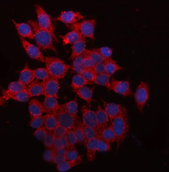 Anti-QPRT Antibody