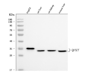Anti-QPRT Antibody