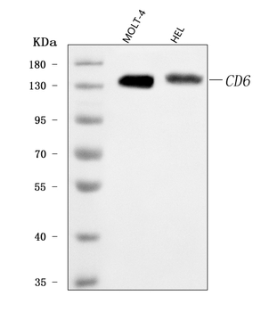 Anti-T12/CD6 Antibody