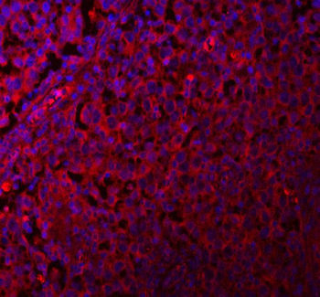 Anti-QARS1 Antibody