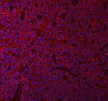 Anti-QARS1 Antibody